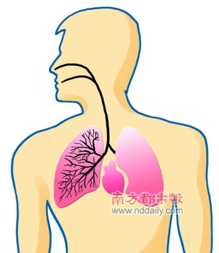 城市黑肺