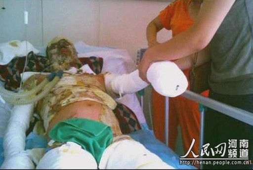 河南葉縣福龍食品公司發(fā)生鍋爐爆炸 造成一死兩傷